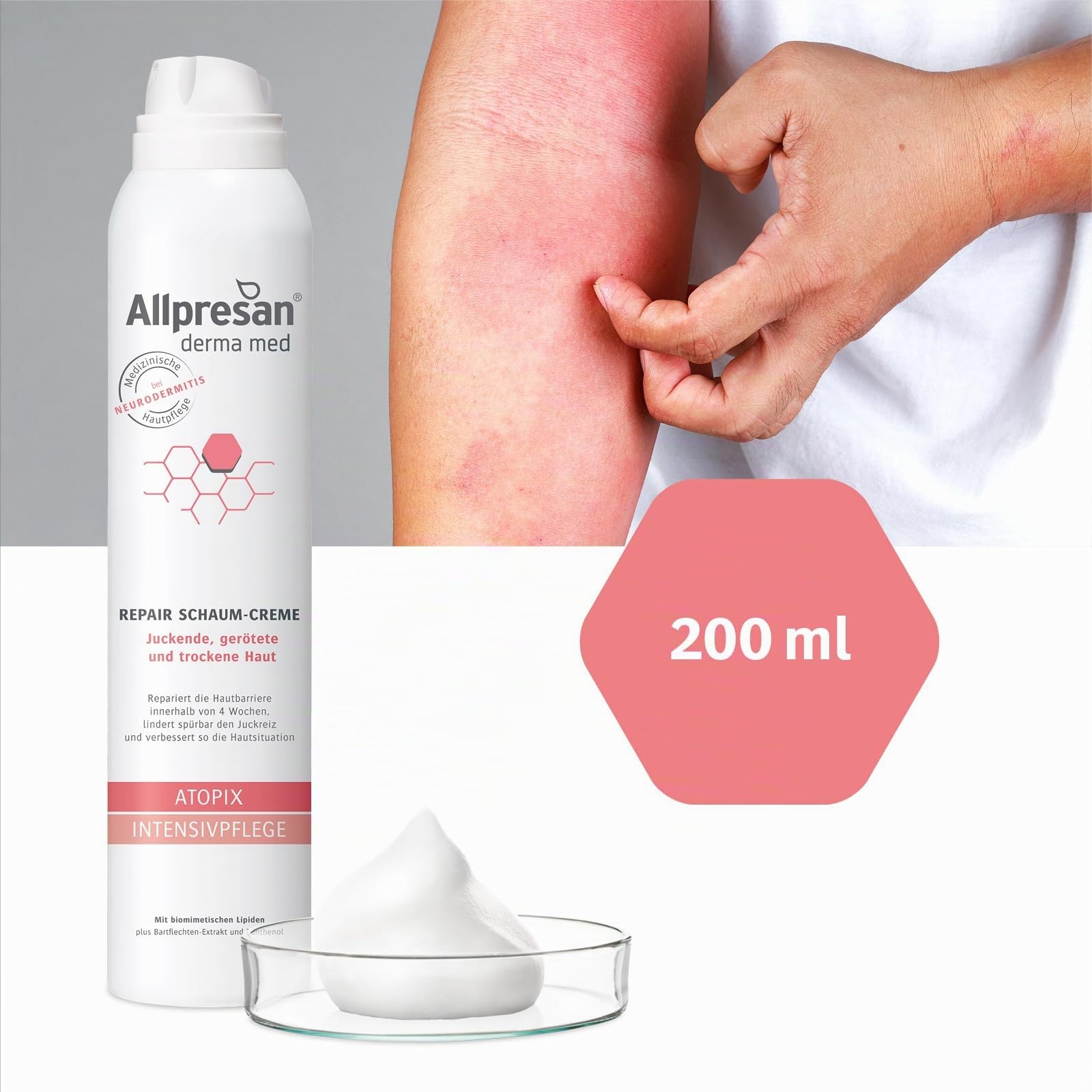 allpresan-derma-med-atopix-schaum-creme-200-ml-neurodermitis-juckreiz image 4