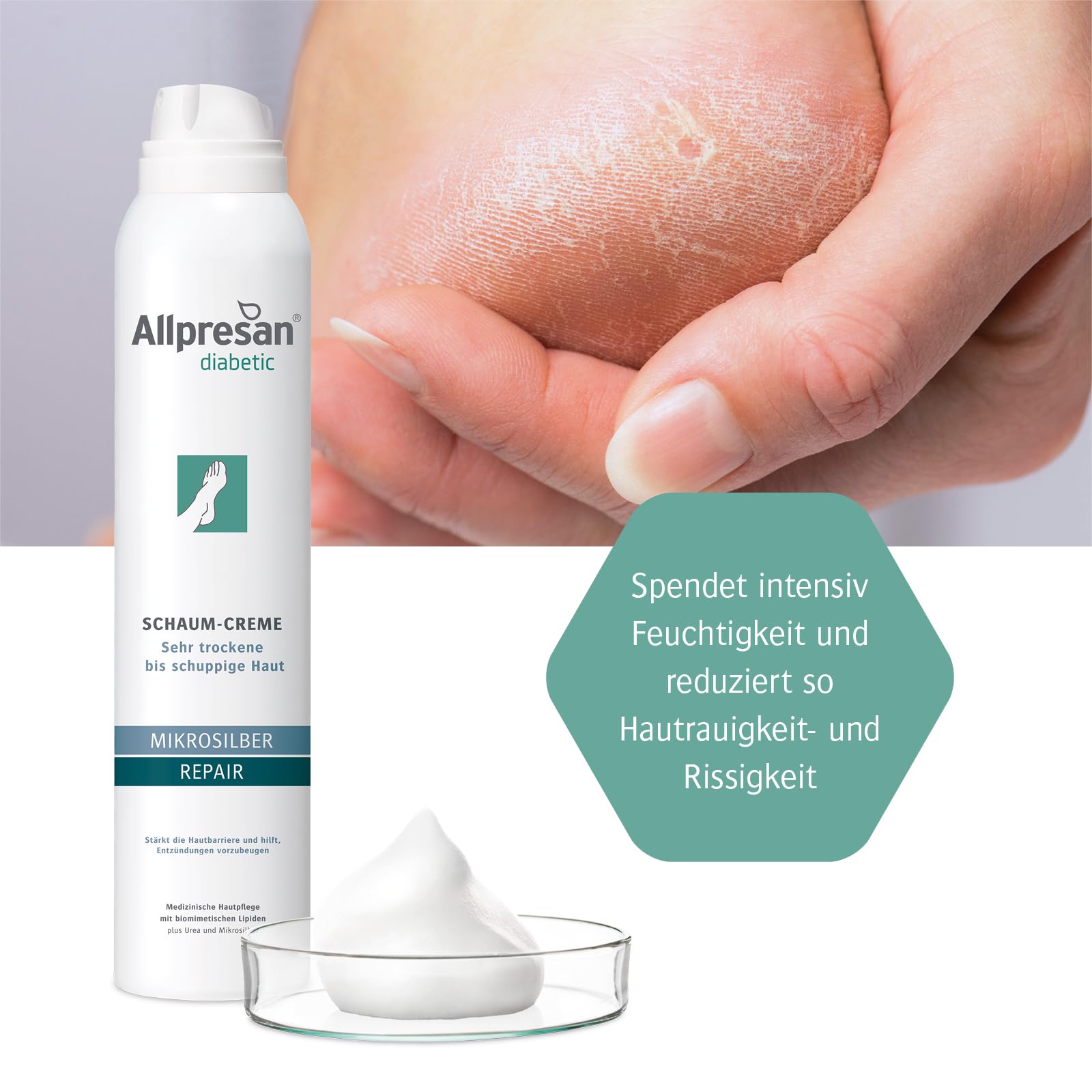 allpresan-diabetic-mikrosilber-schaum-creme-2x200-ml-repair image 5