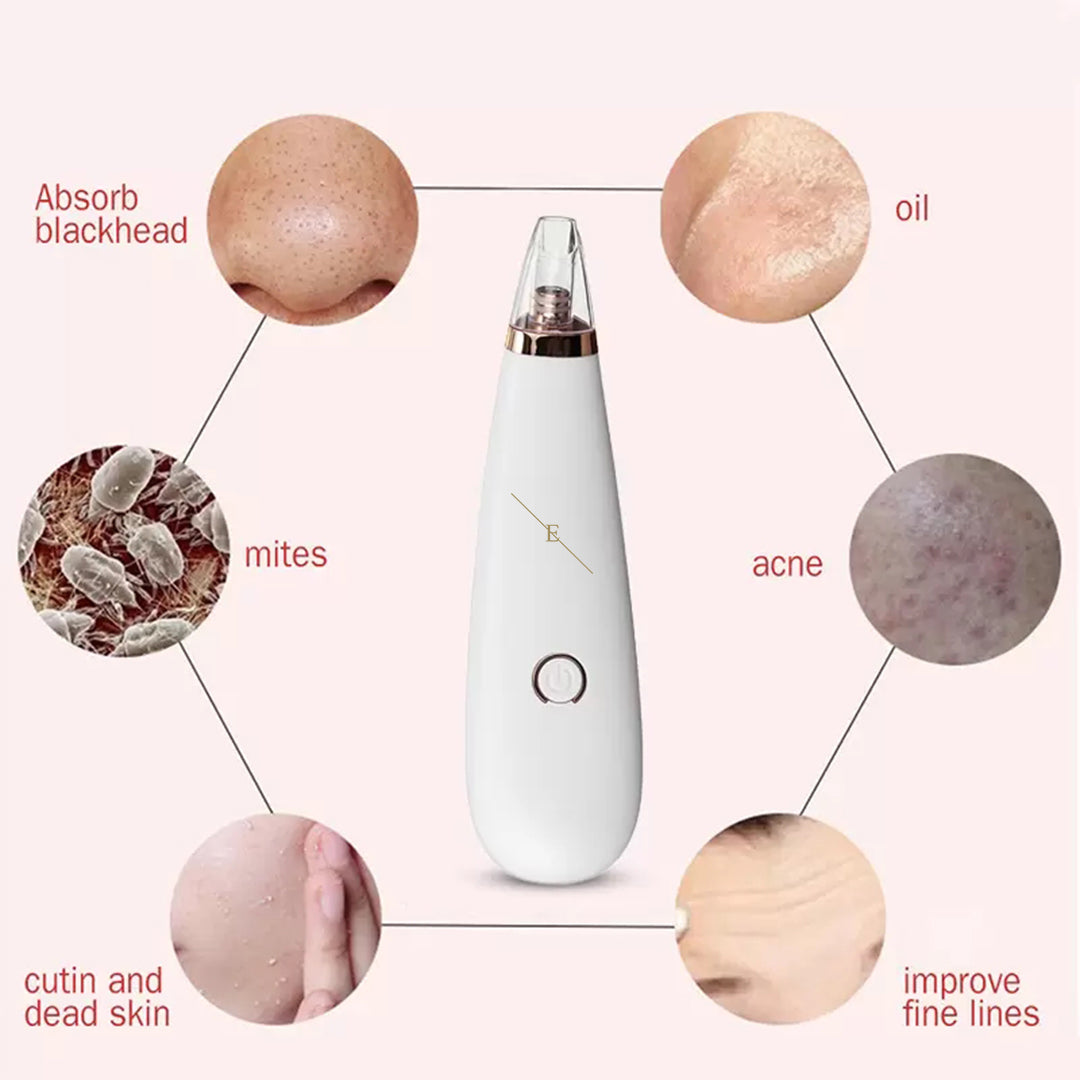 erth-skin-pore-vacuum-porenreiniger-gegen-mitesser image 5