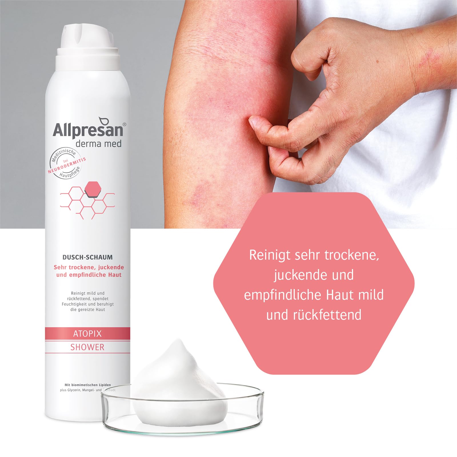 allpresan-atopix-derma-med-dusch-schaum-200-ml-neurodermitis image 4